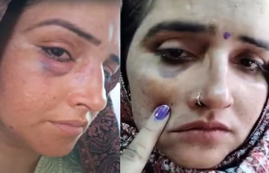 सीमा हैदर के चेहरे पर चोट के निशान, पहले पति ने वीडियो शेयर कर सचिन पर लगाया मारपीट का आरोप 
