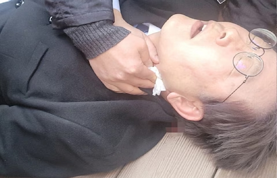 दक्षिण कोरिया में विपक्षी नेता ली जे-म्युंग पर जानलेवा हमला, प्रेस कॉन्फ्रेंस के दौरान हमलावर ने गर्दन पर चाकू घोंपा 
