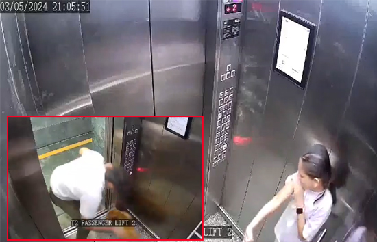 नोएडा : लिफ्ट में कुत्ते ने बच्ची पर किया अचानक अटैक, वीडियो वायरल 