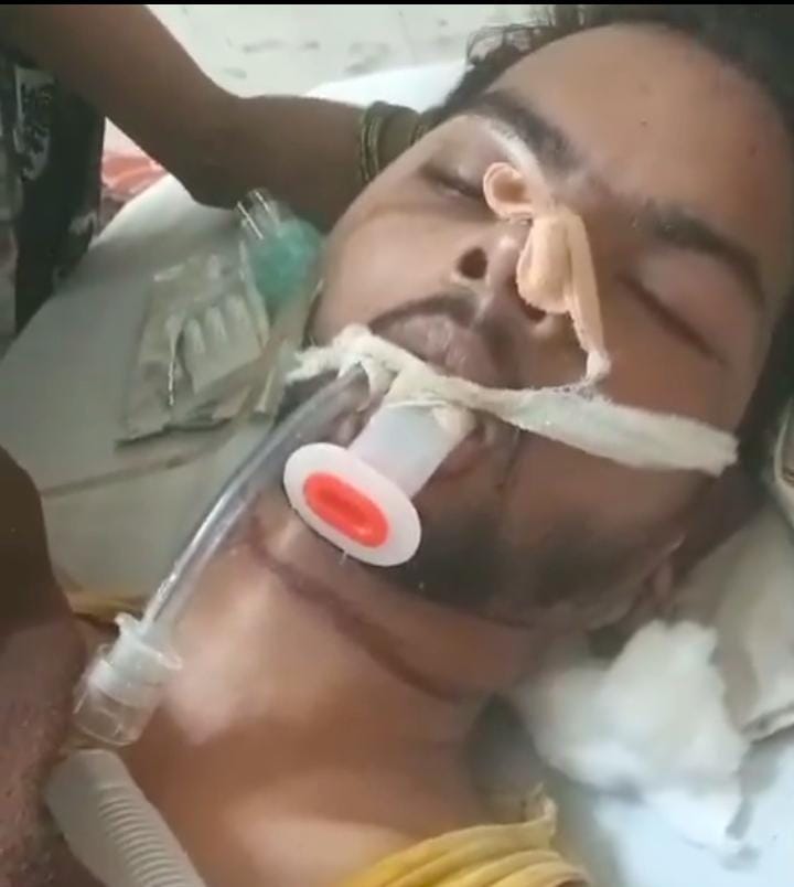 आर्थिक मदद की उम्मीद में जिंदगी की जंग हारा सोनू कुमार, सरकार के बाद सपा ने भी नही दी आर्थिक मदद...