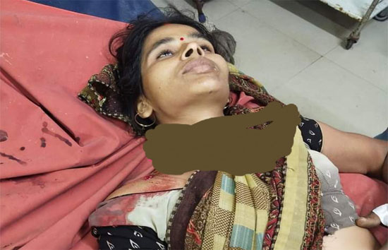 यूपी : बदमाशों ने सपा नेता की पत्नी को मारी गोली, फरार 