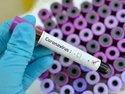 लखनऊ में कोरोना से दो लोगों की मौत, 212 नए मरीज वायरस से संक्रमित