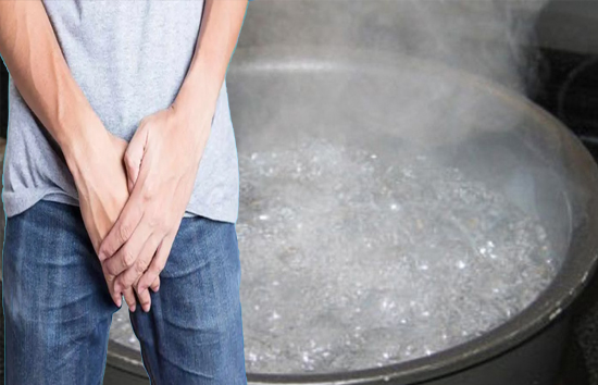 पत्नी को पति पर था किसी दूसरी महिला के साथ अफेयर का शक, प्राइवेट पार्ट पर डाला गर्म पानी, 50 फीसदी तक जला