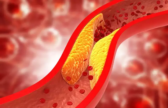 क्यों बढ़ता है cholesterol? जानें मुख्य कारण