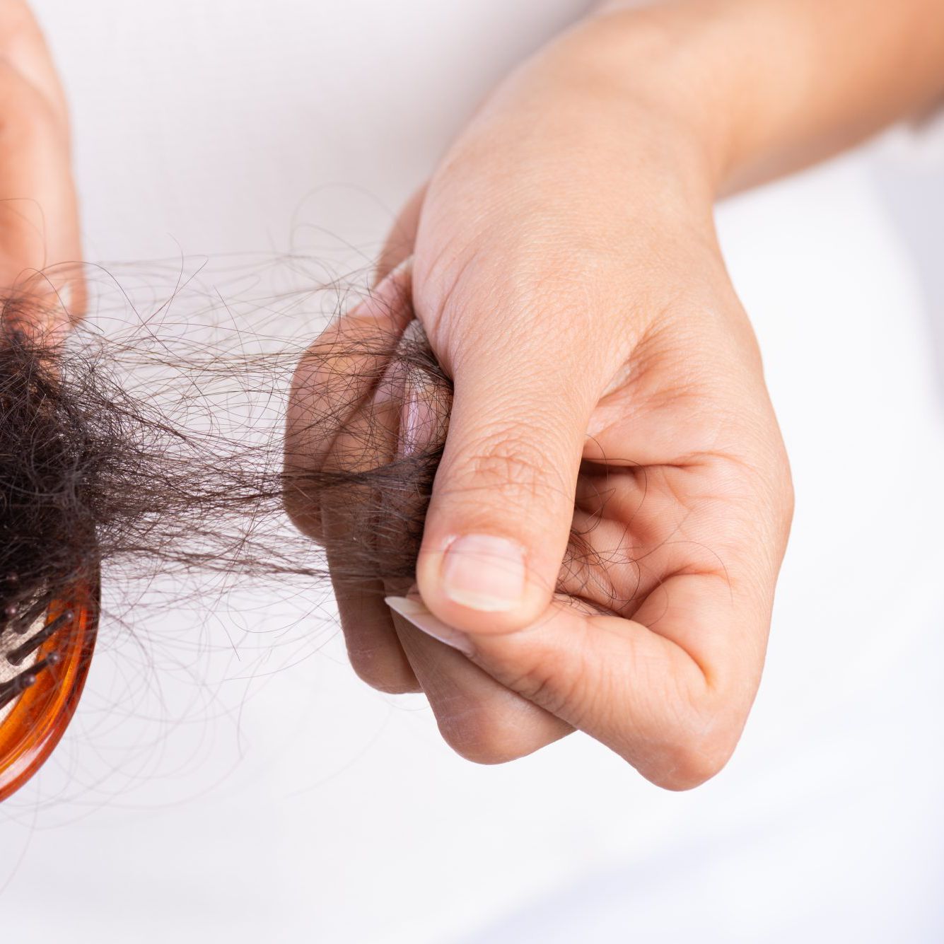 Causes Of Hair Loss, Homeopathic Remedies For Hair fall