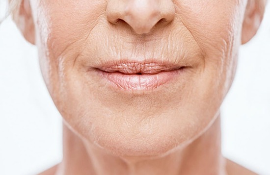 इन चीजों से करें कोलेजन Collagen की कमी दूर