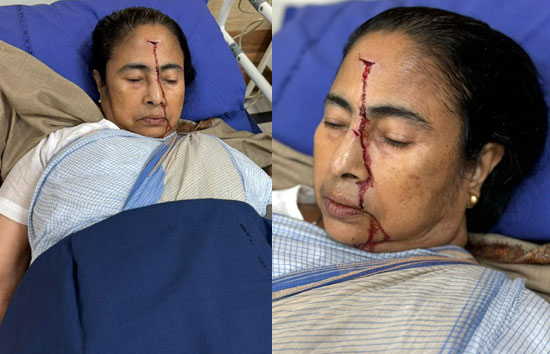 ममता बनर्जी के सिर में लगी गहरी चोट, TMC फोटो शेयर कर दी जानकारी 