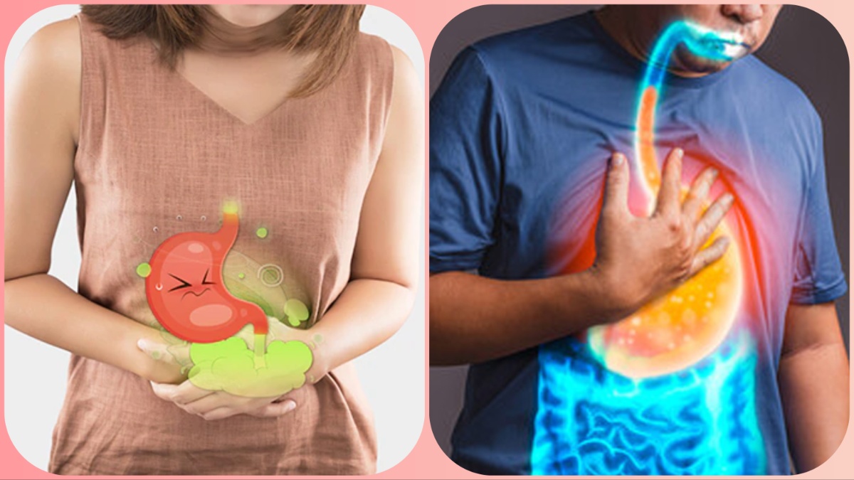 अगर आप भी एसिडिटी और गैस की समस्या से हैं परेशान तो करें ये उपाय