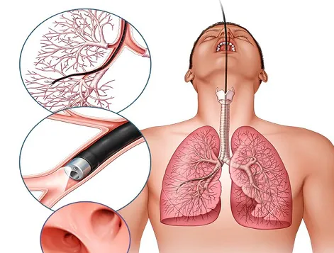 Coronavirus:कोविड-19 से बचने के लिए ऐसे बनाएं अपने फेफड़ों को मजबूत 